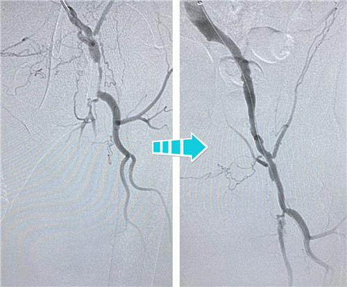 拼2改 - 副本.jpg